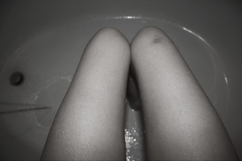 woman's legs, with a bruise, seated in tub